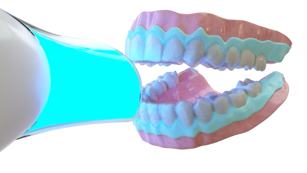 Zahnaufhellung / Bleaching