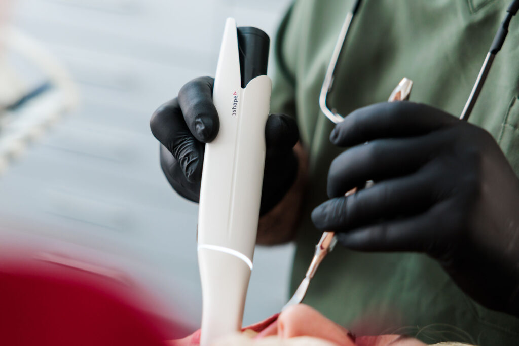 Intraoralscanner | Zahnarzt Schwäbisch Gmünd