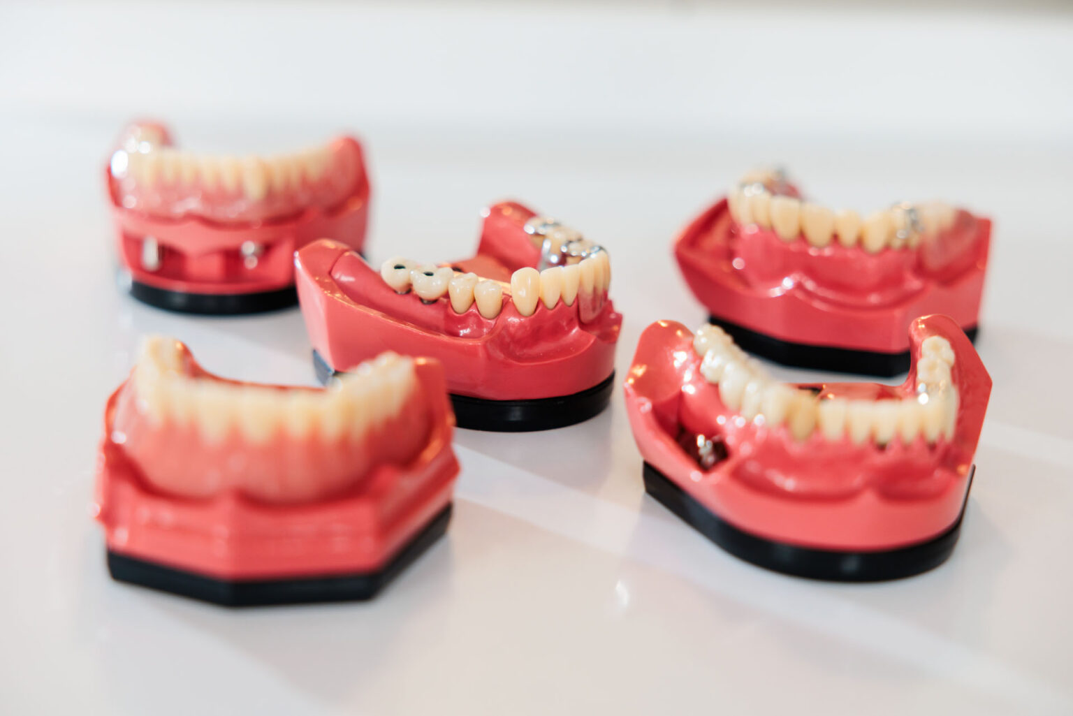 Zahnlabor | Zahnarzt Schwäbisch Gmünd